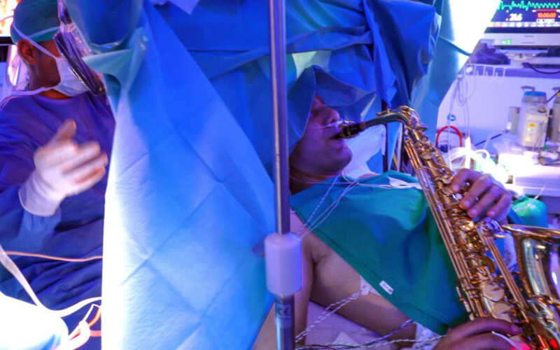 SANITA’ – A Roma un 35enne operato per un tumore cerebrale da sveglio mentre suona il sassofono
